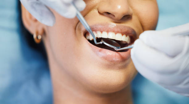 Best Knocked-Out Tooth Emergency  in Laurel, MD